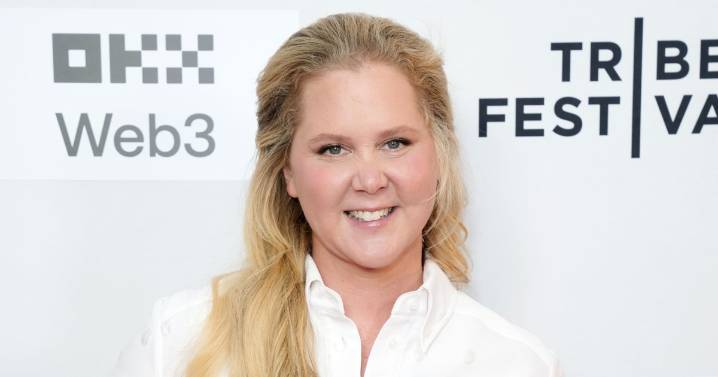 Amy Schumer Shows Off Her Legs Amid Weight Loss in New Pic