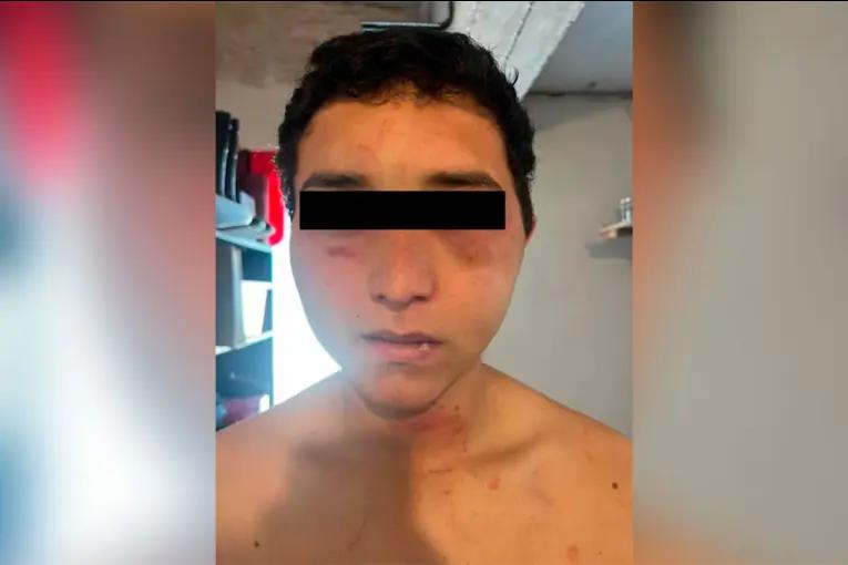 Un trabajador rural fue torturado y amenazado por sus jefes en una estancia: “Me sacaron la oreja con los dientes”