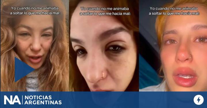 Las preocupantes fotos que publicó Flor Vigna