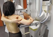 Buruaga dice que las críticas de Ammucam al cribado de cáncer son «poco afortunadas»