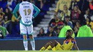América pierde en 30 minutos a 3 jugadores