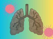 Un medicamento oral podría reemplazar a la quimioterapia en este tipo de cáncer de pulmón
