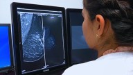 Chihuahua Registra 237 Defunciones por Cáncer de Mama en lo que Va del Año