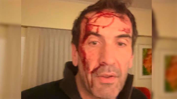Brutal asalto al candidato Pablo Cervi: “Le gatillaron varias veces y lo golpearon”