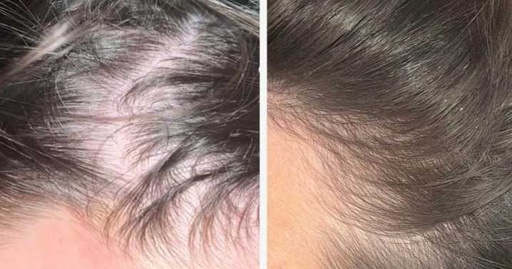 Woman, 53, thought she ruined her hair forever until she found 65p