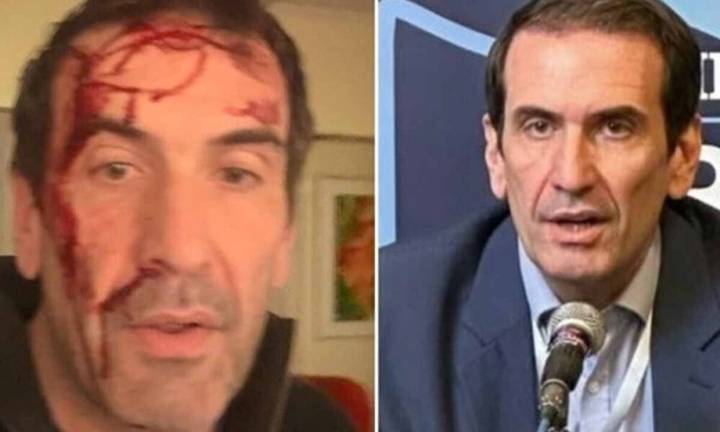 Violento asalto a Pablo Cervi, candidato libertario en Neuquén: "Le gatillaron varias veces"