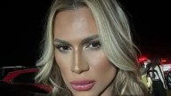 Instagram star, 31, dies after dangerous ‘fox eyes’ surgery as face infection left him believing his ‘veins had burst’