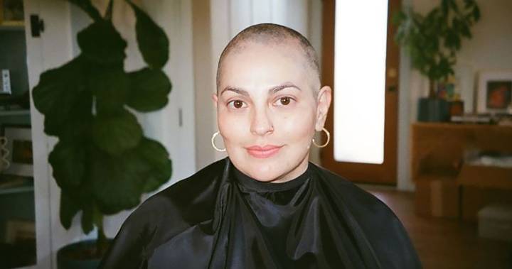 What I Learned Caring for My Bald Head During Chemotherapy