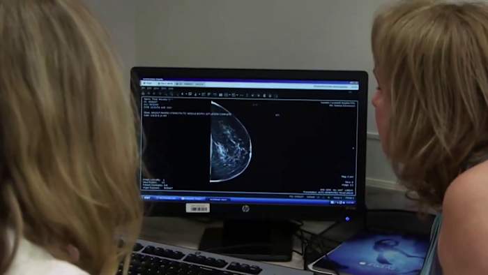 Breaking down breast cancer’s financial impact, the cost of care
