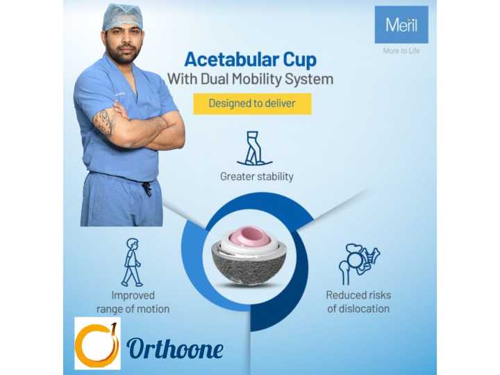 Modern Hip Replacement: Greater Stability and Longer Life