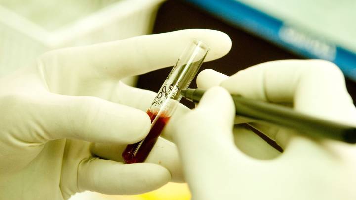Jharkhand news: 5 kids suffering from thalassemia test HIV