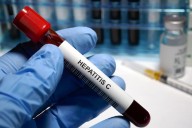 Hepatitis C: causas, síntomas, diagnóstico y tratamiento de esta enfermedad curable