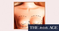 Breast implant explant trend: Alyssa Milano and other celebrities ditching large implants like those of Kylie Jenner for smaller, natural look