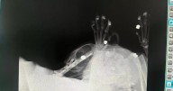 Brutal X-ray images as rescue cat is blasted with gun 'eight times' in Salford